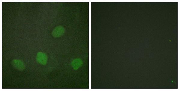 a00577s142 1 creb1 primary antibodies if testing 5