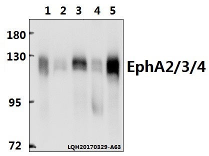 Western blot (WB) analysis of EphA2/3/4 (T587) polyclonal antibody at 1:500 dilution
Lane1:Hela whole cell lysate(40ug)
Lane2:HEK293T whole cell lysate(40ug)
Lane3:MEF whole cell lysate(40ug)
Lane4:C6 whole cell lysate(40ug)
Lane5:PC12 whole cell lysate(40ug)