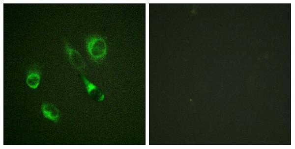 Immunofluorescence analysis of HeLa cells, using EPHA2/3 (Phospho-Tyr588/596) Antibody
