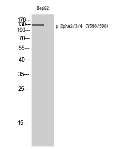 Western Blot analysis of HepG2 cells using Phospho-EphA2/3/4 (Y588/596) Polyclonal Antibody