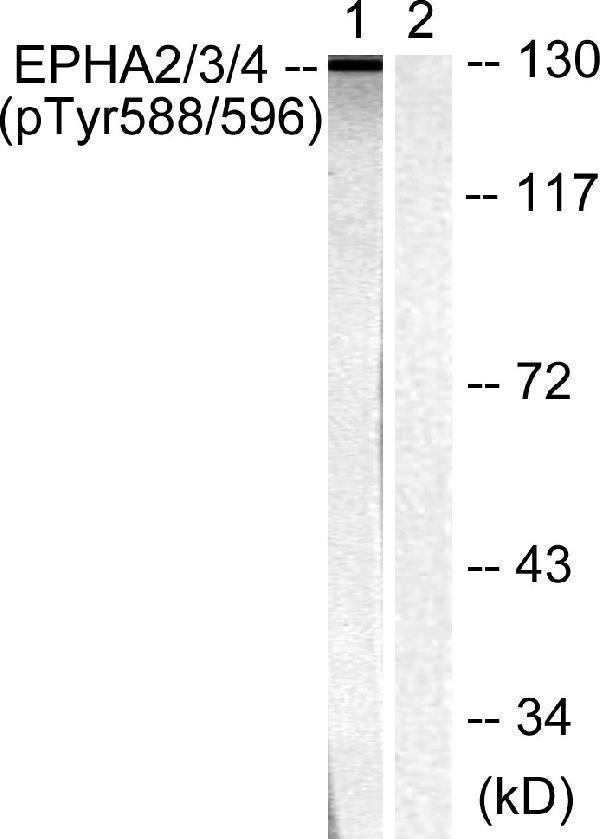 Western blot analysis of lysates from HepG2 cells, using EPHA2/3 (Phospho-Tyr588/596) Antibody