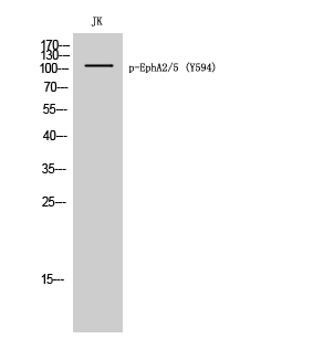 Western Blot analysis of JK cells using Phospho-EphA2/5 (Y594) Polyclonal Antibody