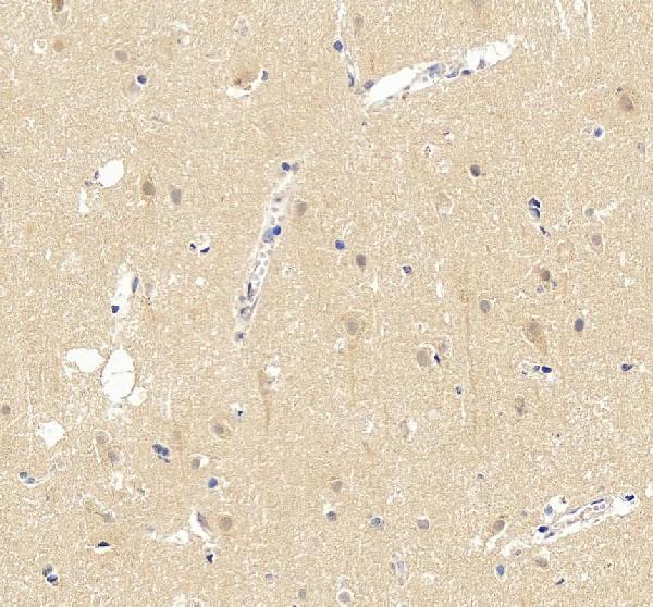IHC analysis of UBE3A using anti-UBE3A antibody (A00582)