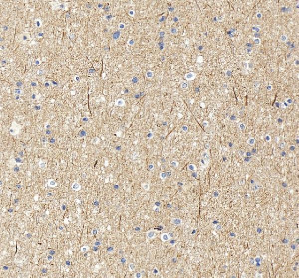 IHC analysis of UBE3A using anti-UBE3A antibody (A00582)