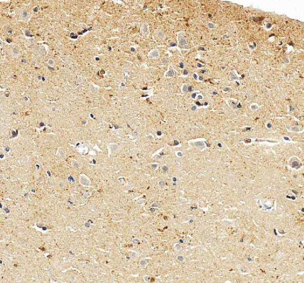 a00582 ube3a primary antibodies ihc testing 6