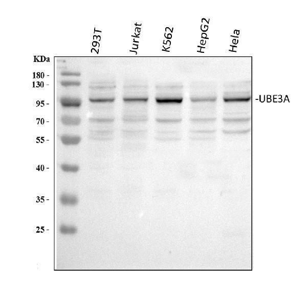  Western blot analysis of UBE3A using anti-UBE3A antibody (A00582)