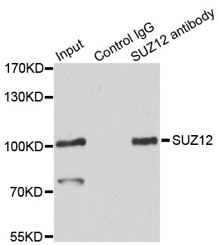 Immunofluorescence analysis of C6 cells using SUZ12 Polyclonal Antibody  at dilution of 1:100 