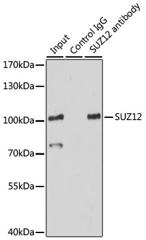 a00583 2 suz12 primary antiboties ip testing 4