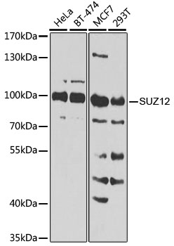 Western blot analysis of extracts of various cell lines, using SUZ12 Antibody  at 1:1000 dilution