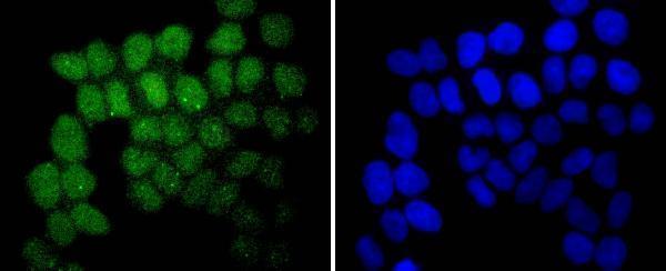 ICC staining SUZ12 in Hela cells (green)