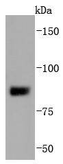 Western blot analysis of SUZ12 on MCF-7 cells lysates using anti-SUZ12 antibody at 1/1,000 dilution
