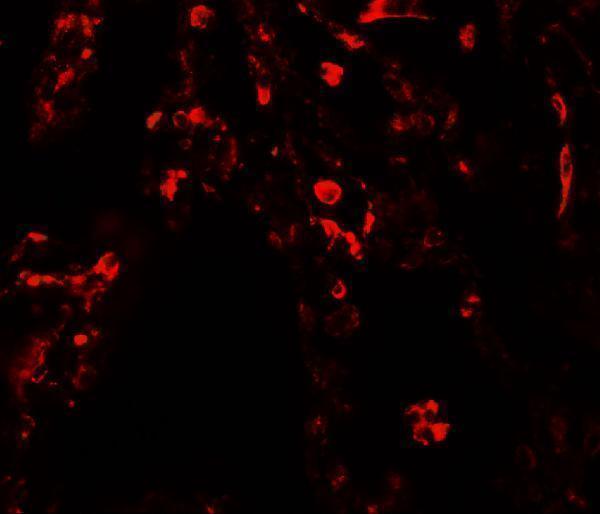 Immunofluorescence of SUZ12 in human lung tissue with SUZ12 antibody at 20 μg/mL