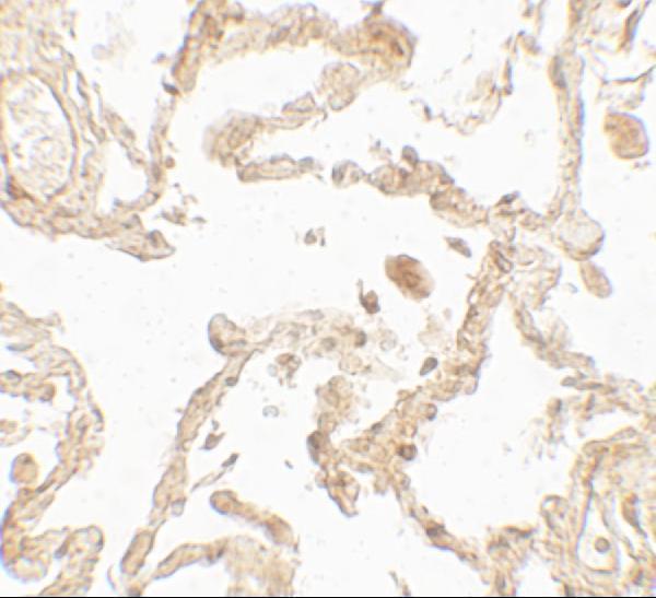 Immunohistochemistry of SUZ12 in human lung tissue with SUZ12 antibody at 5 μg/mL