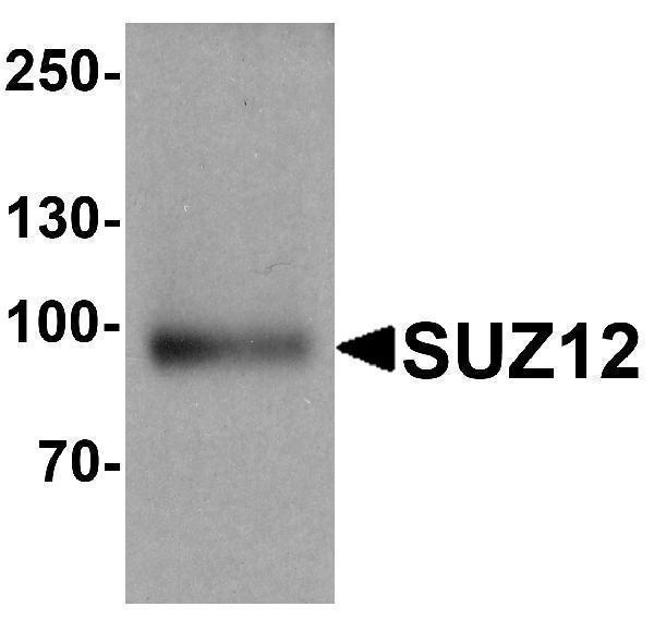 Western blot analysis of SUZ12 in human liver tissue lysate with SUZ12 antibody at 1 μg/ml