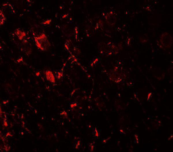 Immunofluorescence of ULK1 in rat brain tissue with ULK1 antibody at 20 μg/ml