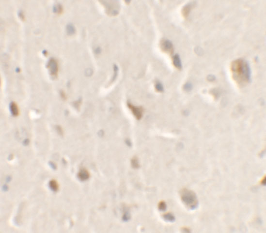 Immunohistochemistry of ULK1 in rat brain tissue with ULK1 antibody at 2