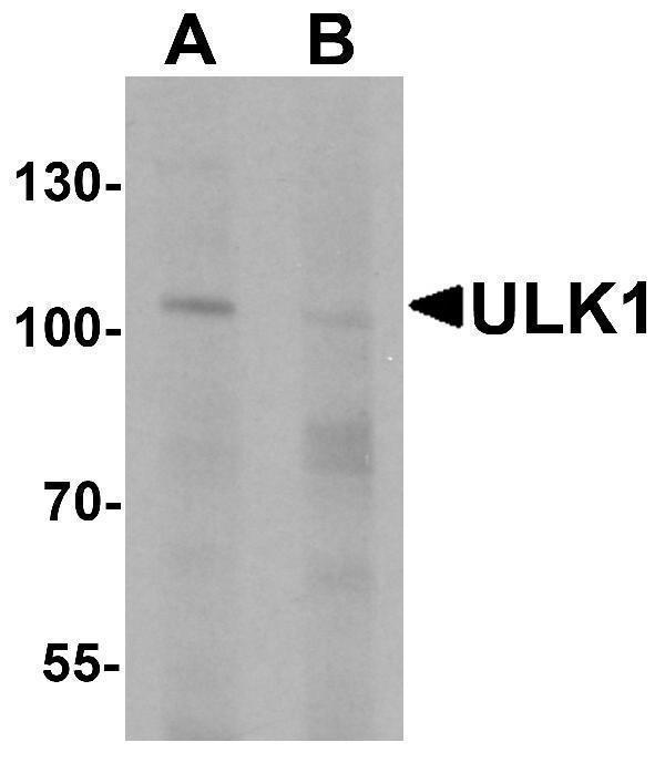 Western blot analysis of ULK1 in rat brain tissue lysate with ULK1 antibody at 1 μg/mL in (A) the absence and (B) the presence of blocking peptide