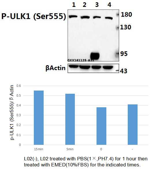 a00584s555 ulk1 primary antiboties wb testing 1