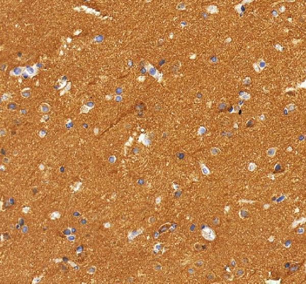 a00585 1 nsf primary antibodies ihc testing 10
