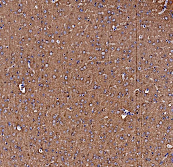 a00585 1 nsf primary antibodies ihc testing 2