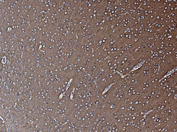 a00585 1 nsf primary antibodies ihc testing 3