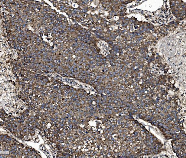 a00585 1 nsf primary antibodies ihc testing 6