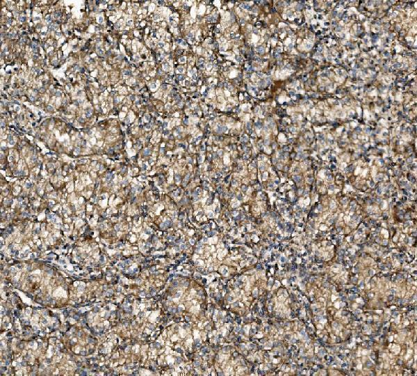 a00585 1 nsf primary antibodies ihc testing 9_1