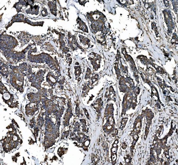 IHC analysis of NSF using anti-NSF antibody (A00585)