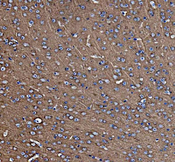 a00585 nsf primary antibodies ihc testing 2