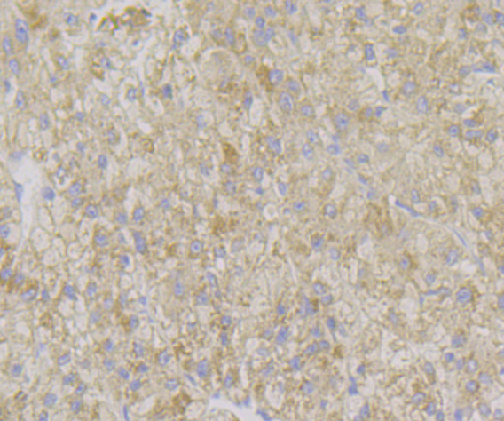 a00586 adamts13 primary antiboties ihc testing 2