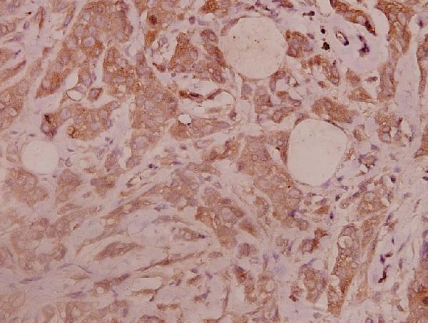 a00587s778 itgb3 primary antiboties ihc testing 2
