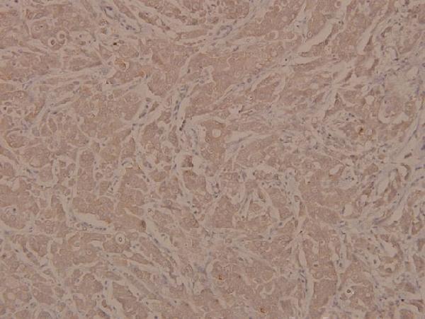 a00587y773 itgb3 primary antiboties ihc testing 2