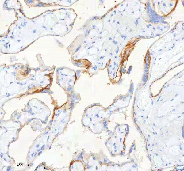 IHC analysis of SCD using anti-SCD antibody (A00588-1)