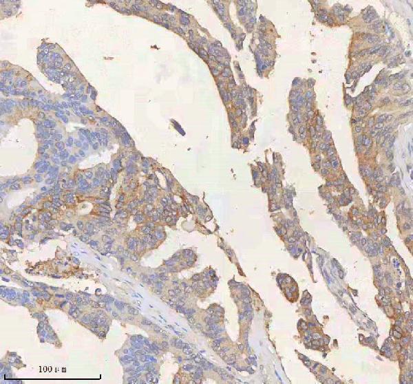  IHC analysis of SCD using anti-SCD antibody (A00588-1)