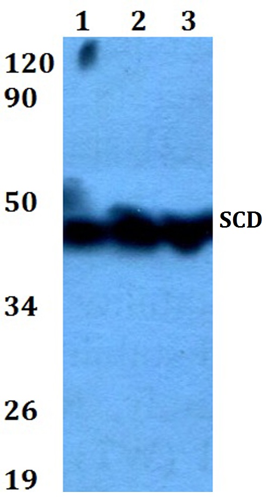 a00588 scd primary antiboties wb testing 1