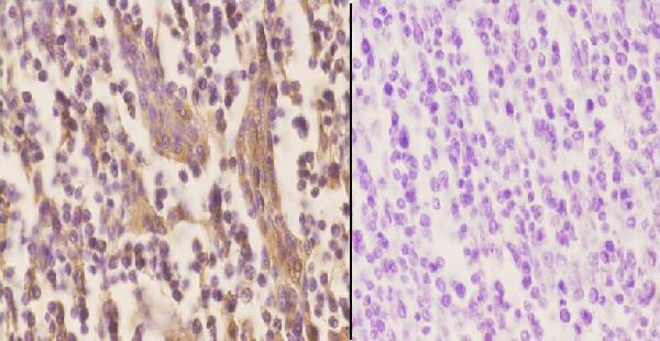 a00590 1 clu primary antiboties ihc testing 2