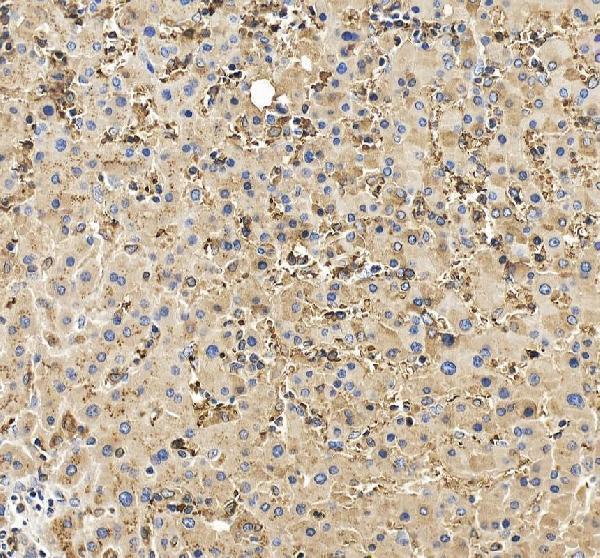 IHC analysis of Clusterin/CLU using anti-Clusterin/CLU antibody (A00590-3)