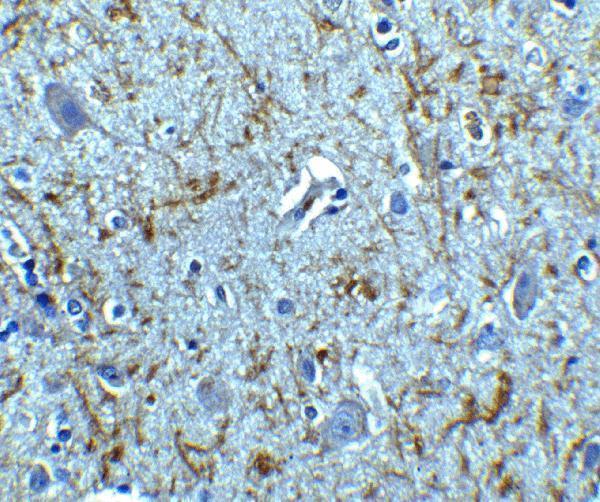 Immunohistochemistry of Clusterin in human brain tissue with Clusterin antibody at 5 μg/mL