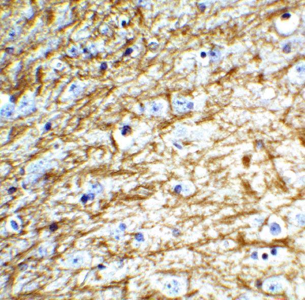 a00590 clu primary antibodies ihc testing 5