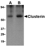 Western blot analysis of Clusterin in human brain tissue lysate with Clusterin body at (A) 0