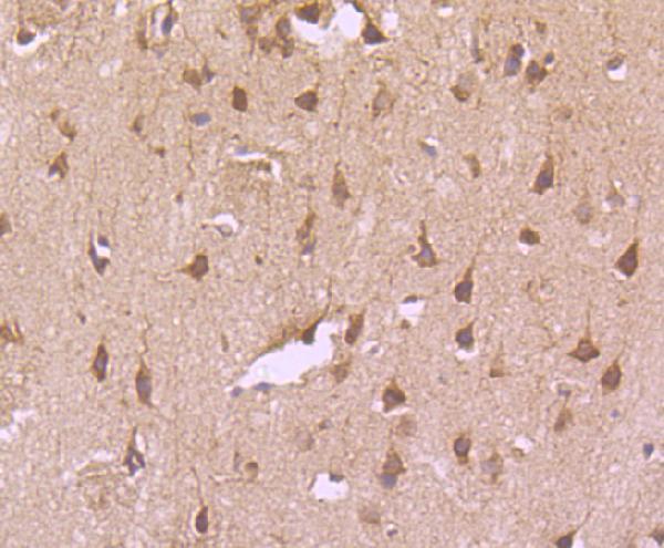 a00591 1 tfrc primary antiboties ihc testing 2