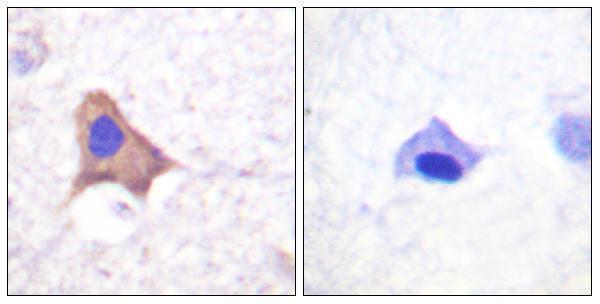 Immunohistochemistry analysis of paraffin-embedded human brain, using CD71/TfR (Phospho-Ser24) Antibody