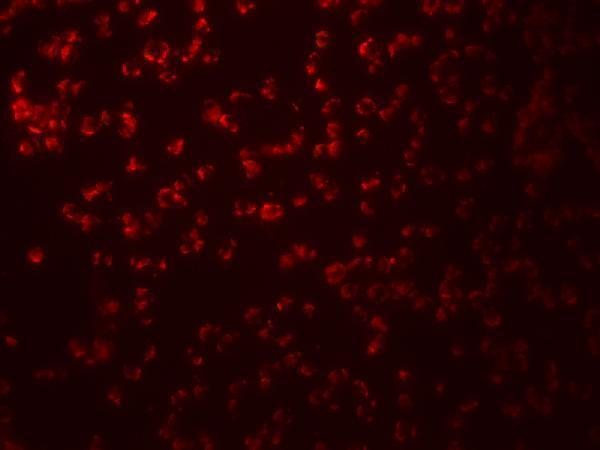 a00592 1 samhd1 primary antibodies if testing 4