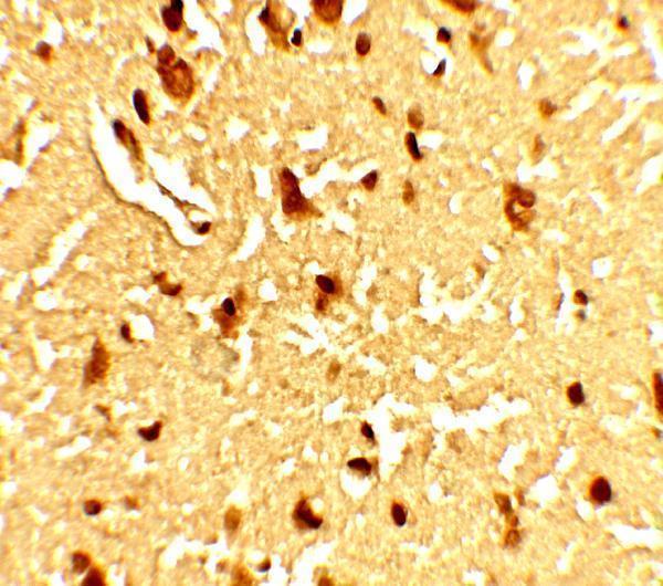 Immunohistochemistry Validation of SAMHD1 in Human Brain Tissue  
Immunohistochemical analysis of paraffin-embedded Human Brain Tissue using anti- SAMHD1 antibody (A00592-1) at 5 μg/ml