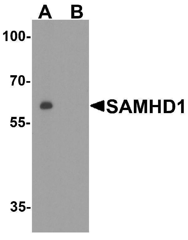 Western Blot Validation in Human Daudi Cell Lines
Loading: 15 μg of lysates per lane