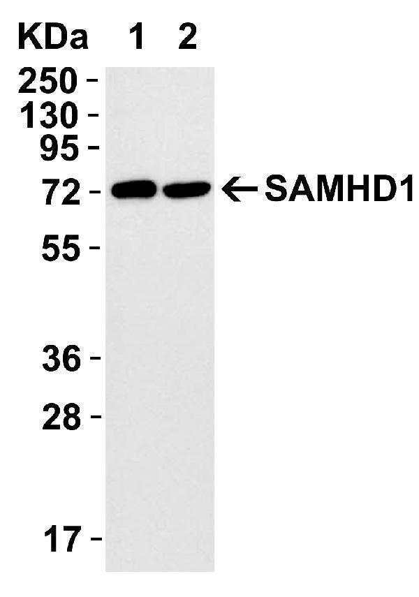 Overexpression Validation in 293T Transfected Cells
Loading: 15 μg of lysates per lane