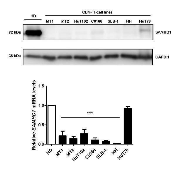 a00592 1 samhd1 primary antibodies wb testing 6