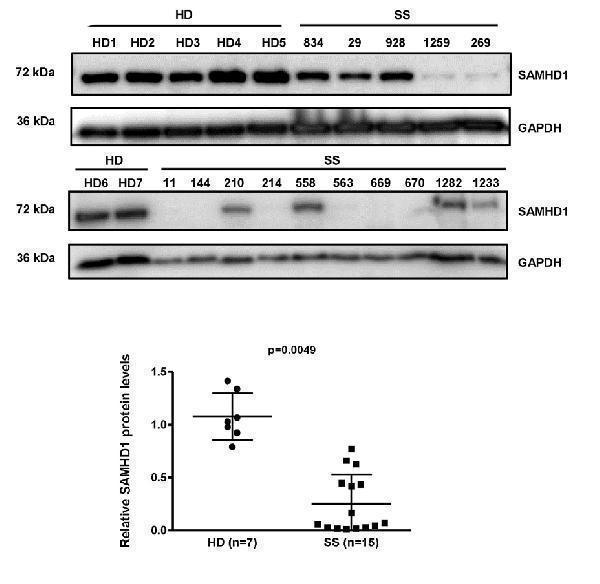 a00592 1 samhd1 primary antibodies wb testing 7