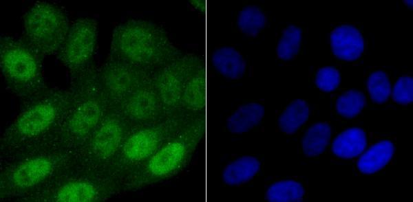 ICC staining SAMHD1 in HepG2 cells (green)