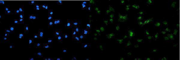 a00592 4 samhd1 primary antibodies if testing 1